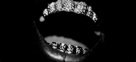 Gold and Diamond Mouth Grillz in Las Vegas, NV